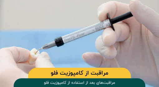 مراقبت‌-بعد-استفاده-کامپوزیت-فلو